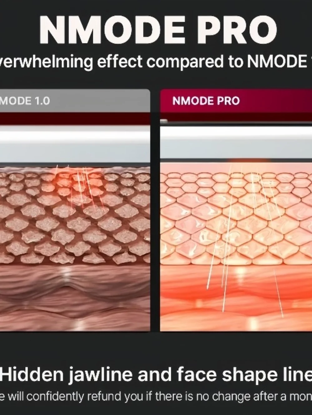 Beaund - Nmode Pro Pink Edition